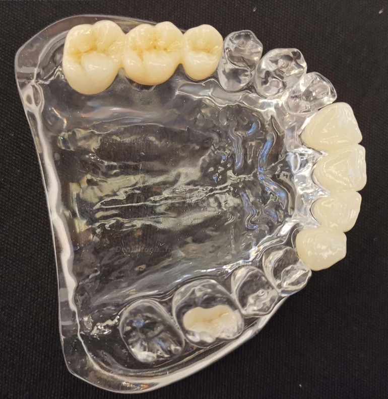 1 Pièce Bloc de zircone multicouche de laboratoire dentaire 3D bloc en céramique CAD/CAM