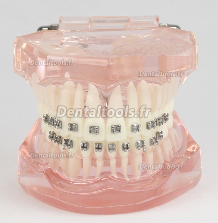 Modèle de traitement d'orthodontie dentaire dents de démonstration Supports métalliques 3001