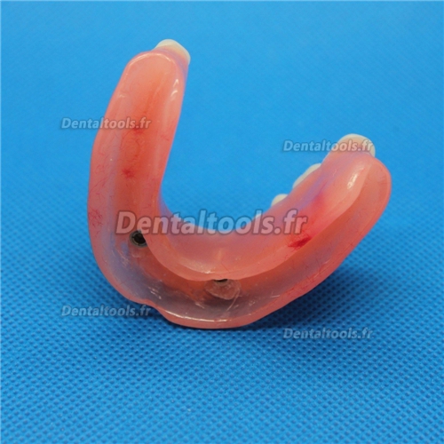 Modèle anatomique dentaire pour réparation d’implant dentaire M-6007