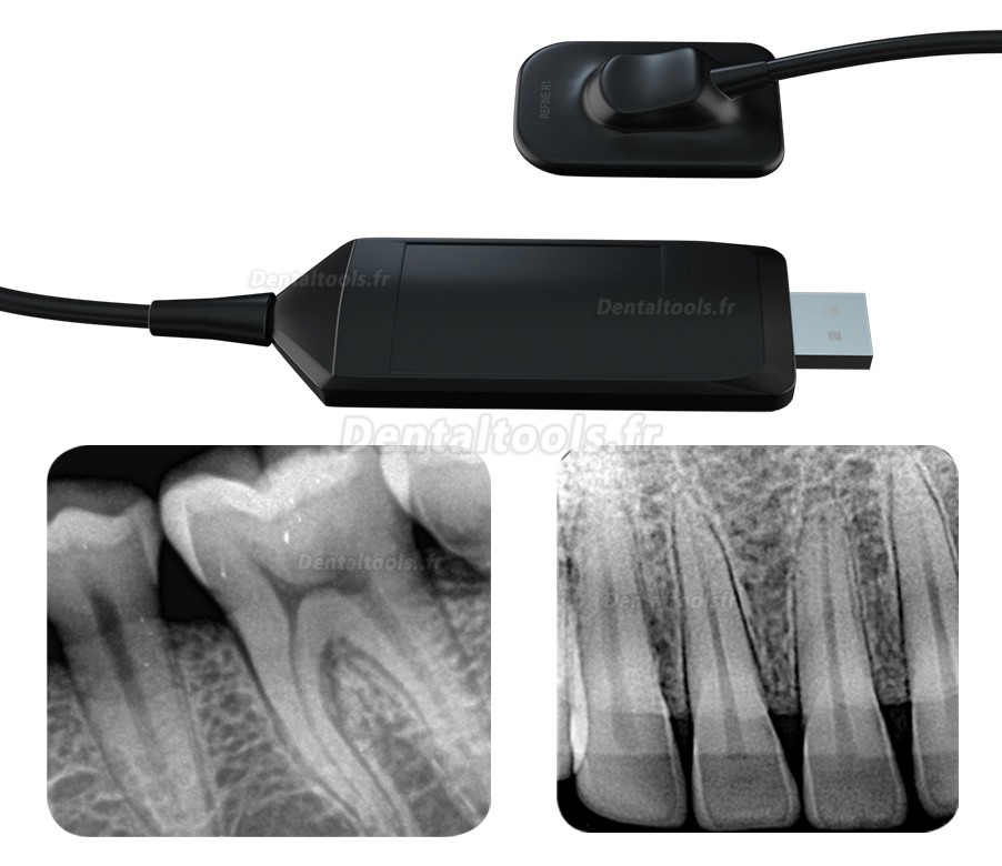 Refine VeRay Kit machine à rayons x dentaire portable + capteur intra-oral RVG