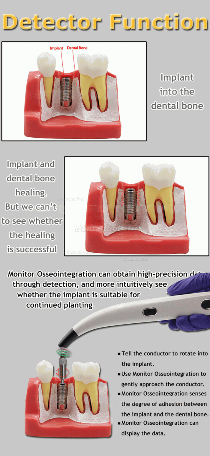 Moniteur de stabilité d'implant dentaire ISQ dispositif de test de stabilité d'implant