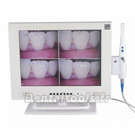 MLG® Caméra intra orale sans filWIFI avec 15" écran LCD M-958A MLG® Caméra intra orale sans filWIFI avec 15" écran LCD M-958A