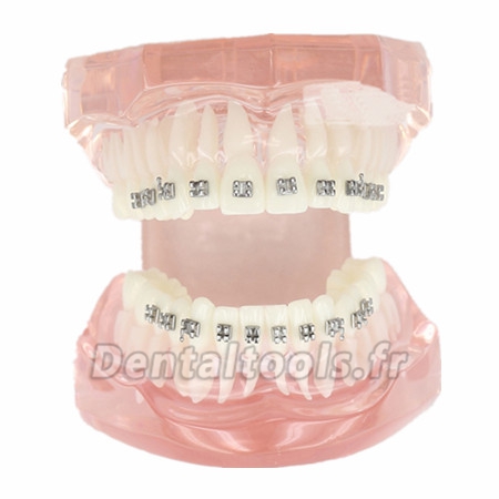 Modèle de traitement d'orthodontie dentaire dents de démonstration Supports métalliques 3001