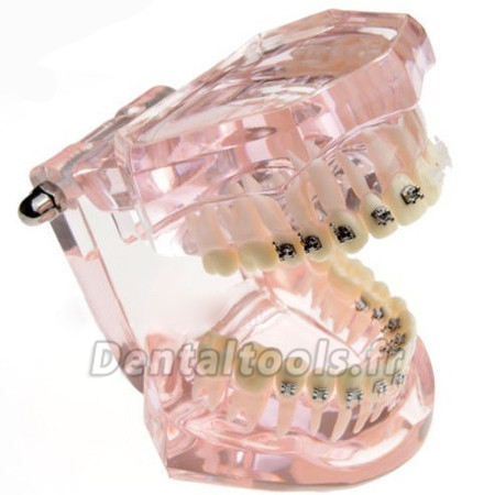 Modèle anatomique dentaire/Orthodontie Contraste des brackets M3009