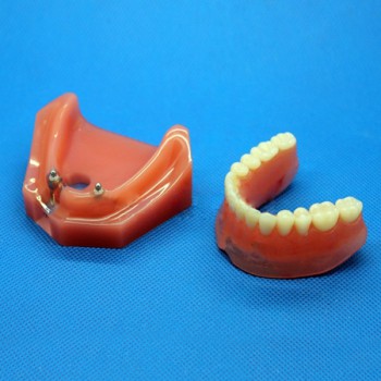 Modèle anatomique dentaire pour réparation d’implant dentaire M-6007