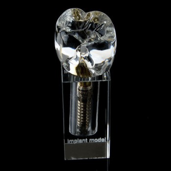 Modèle anatomique dentaire Cristal d'implant dentaire M2019-II