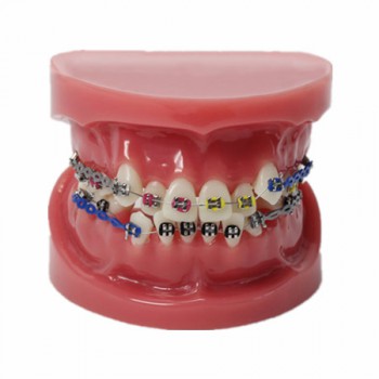 Modèle anatomique dentaire anatomique dentaire/Orthodontique avec arc externe M-...