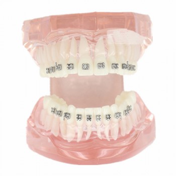 Modèle de traitement d'orthodontie dentaire dents de démonstration Supports méta...