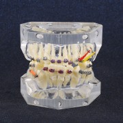 Modèle orthodontique dentaire Traitement de Malocclusion Avec crochets de chaîne SG