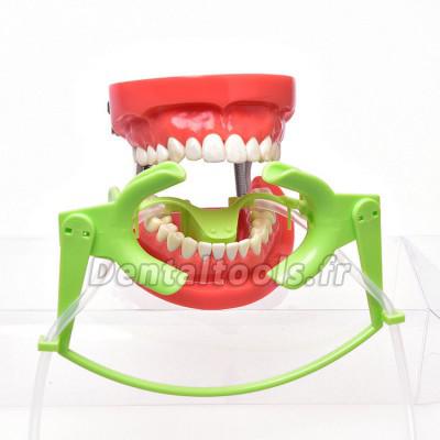 Matériaux dentaires orthodontie kangtian ouverture embouchure Rétracteur de bouche
