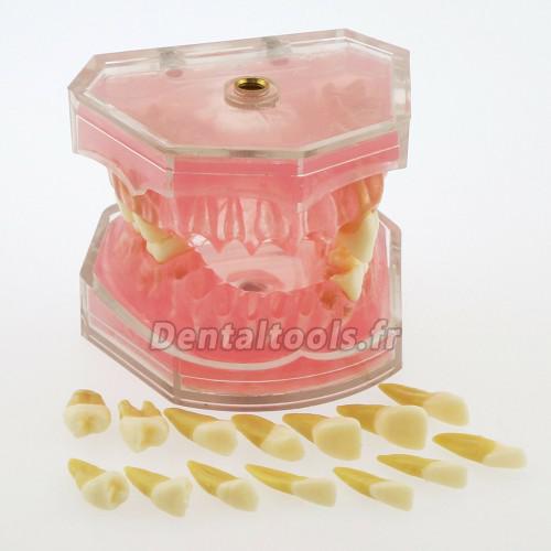 1 Pc modèle dentaire de dents avec 28 pcs amovibles modèle standard 4004 pour éducation