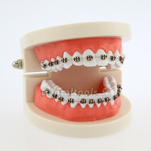 Démonstration Typodont de l'enseignement dentaire Modèle de dents avec attelles pour patient étude 5006