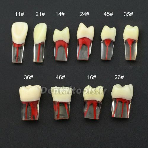 Dents Dentaire RCT Endo Typodont Compatible avec Kilgore Nissin