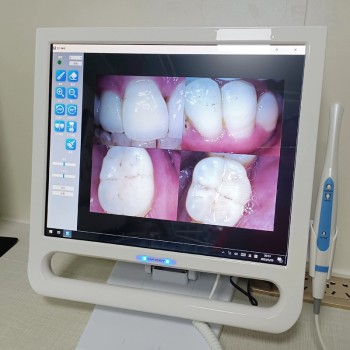 YF-1700P+ Caméra intra-orale écran tactile de 17 pouces pour unité dentaire avec...