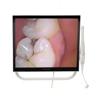 Magenta YFHD-D Caméra intra-orale dentaire 1/4 Sony CCD moniteur 17 pouces et bras de support