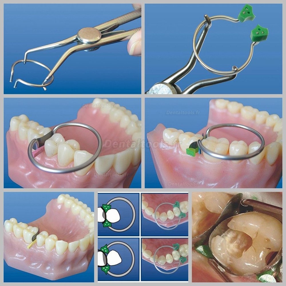 1pc Miroir Dentaire en Acier Inoxydable, Miroir de Dentiste, Miroir Buccal  Dentaire, Outils de Laboratoire Dentaire, Instrument de Blanchiment des Den