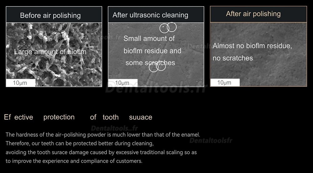 Woodpecker AP-H Plus Polisseur pneumatique dentaire supra-gingival/sous-gingival