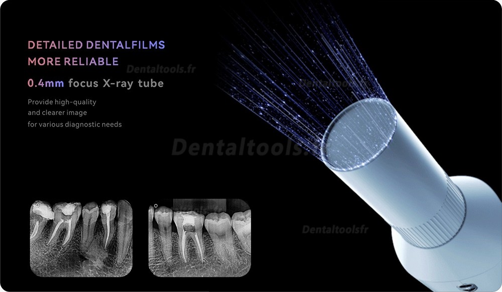 Woodpecker Ai Ray Appareil de radiographie dentaire portable Haute fréquence CC ecran tactile