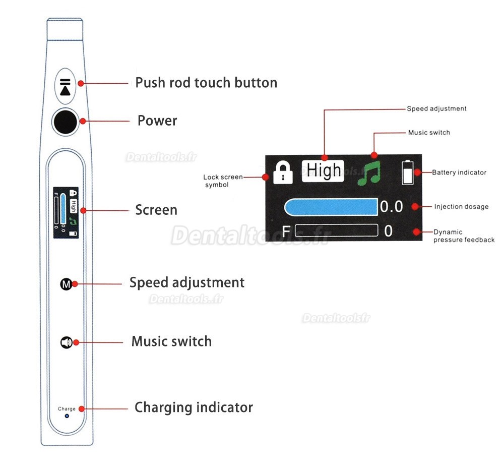 Stylo d'anesthésie indolore sans fil d'injecteur d'anesthésie dentaire électrique