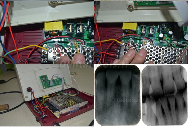BLX-5 Appareil Radiographique dentaire portable