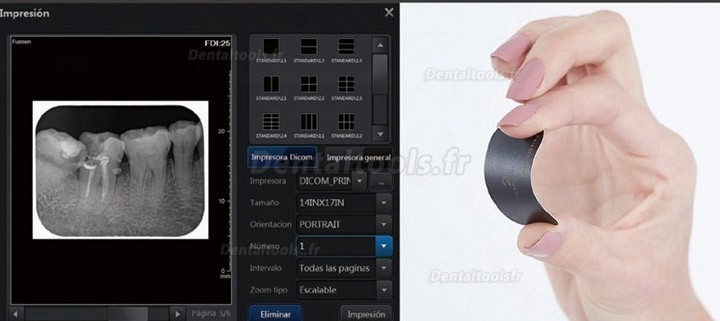 Fussen F200 Scanner de Plaque au Phosphore Système de Radiologie Numérique par Plaque au Phosphore