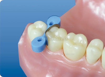 https://www.dentaltools.fr/images/upload/Image/Fixed-Matrix-4.jpg