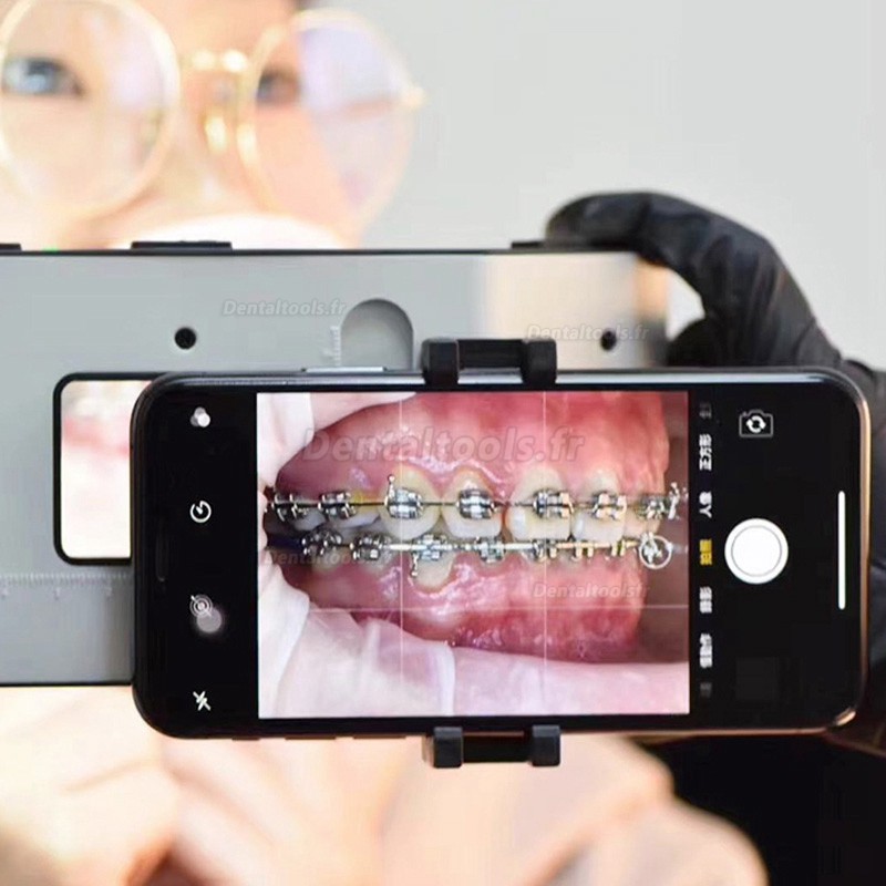 Lumière de photographie dentaire lumière de remplissage LED orale pour téléphone portable