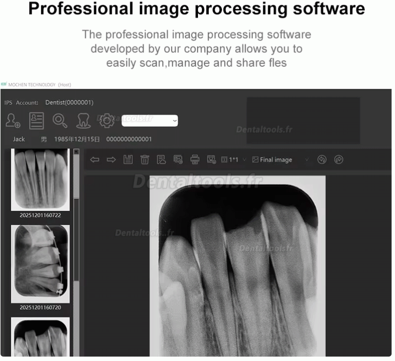 Handy IPS3 scanner PSP dentaire pour plaques d'imagerie radiographique
