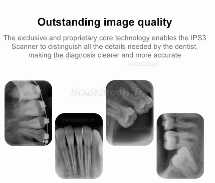 Handy IPS3 scanner PSP dentaire pour plaques d'imagerie radiographique