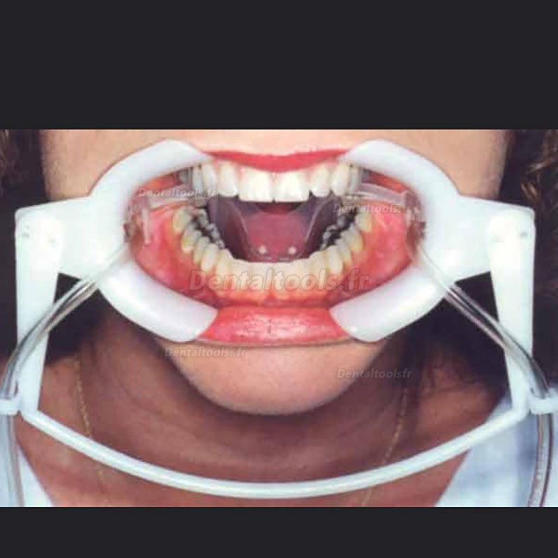 1Pcs Écarteur bouche dentaire avec tube d'aspiration sous-salive ouvre-bouche dentaire