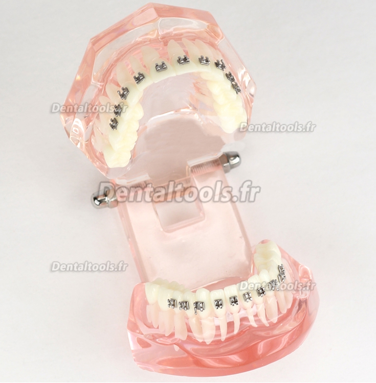 Modèle de traitement d'orthodontie dentaire dents de démonstration Supports métalliques 3001