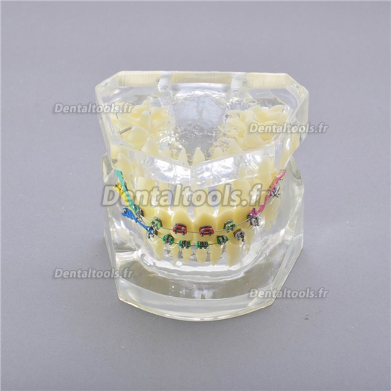 M-3005 Modèle anatomique dentaire dentaire II traitement des chevauchements dentaires