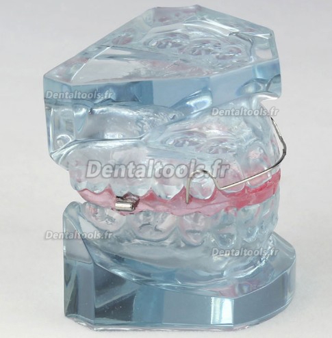 Modèle anatomique dentaire de la contention après le traitement orthodontique M-3006