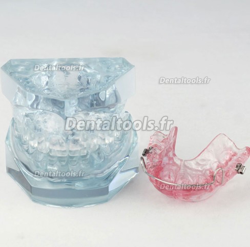 Modèle anatomique dentaire de la contention après le traitement orthodontique M-3006