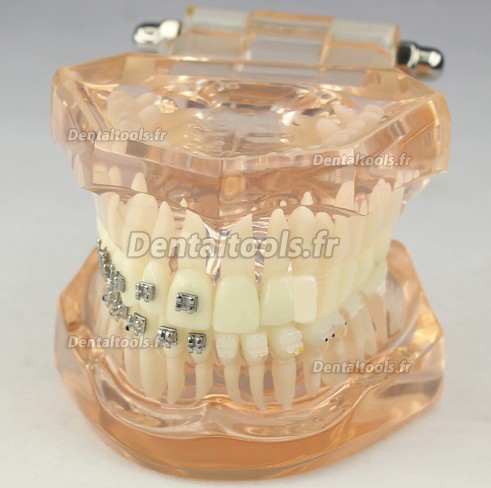 Modèle anatomique dentaire/Orthodontie Contraste des brackets M3009
