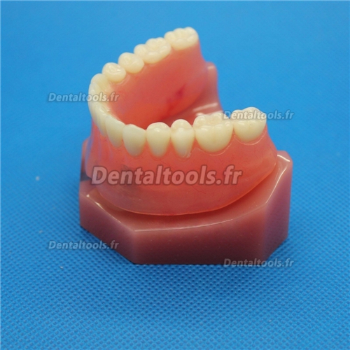 Modèle anatomique dentaire pour réparation d’implant dentaire M-6007
