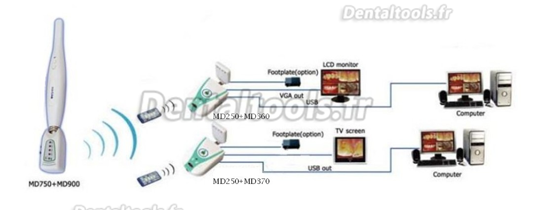 Magenta® Caméra intra orale sans fil MD750+MD360+MD900+MD250 USB & VGA