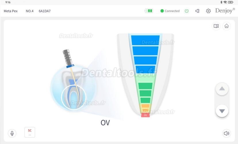 Denjoy MeteEndo Système d'unité de chariot endo intégré dentaire mobile (Moteur endo + testeur de pulpe + localisateur d'apex + système d'obturation)