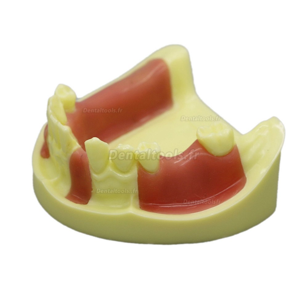 Modèle dentaire #2004 01 - Modèle de pratique d'implant de la mâchoire inférieure avec gencive