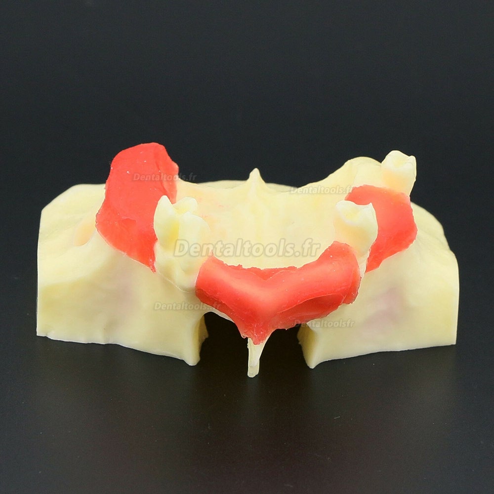 1Pc Modèle de dents dentaires pour éducation et enseignement Modèle de pratique de soulèvement des sinus 2013 01