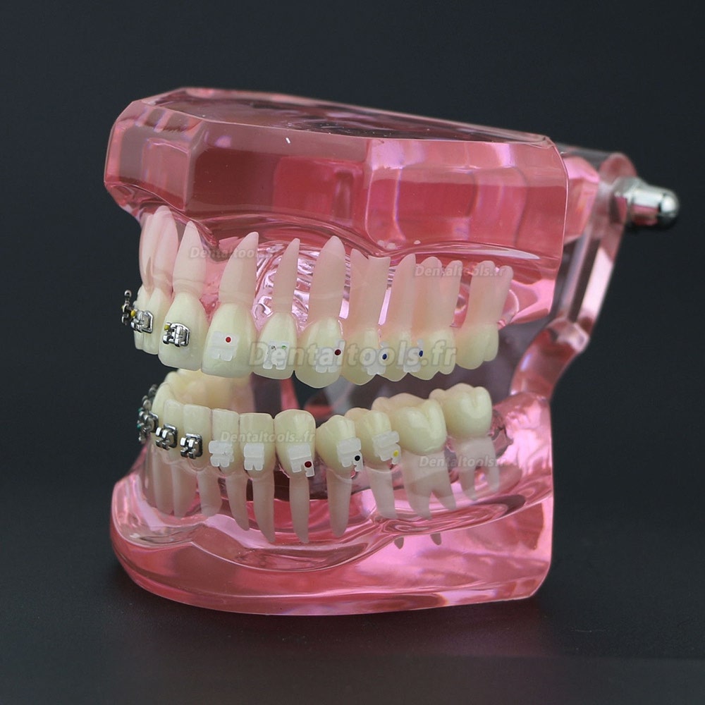 Modèle de Dents Dentaire Orthodontique Bracket métal et céramique étude 3003