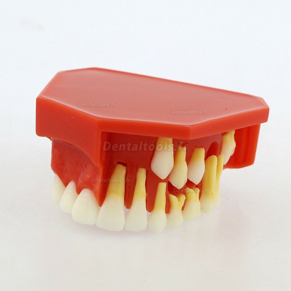 Démonstration alternative dentaires de dents permanentes Modèle 4006# pour l’éducation et enseignement