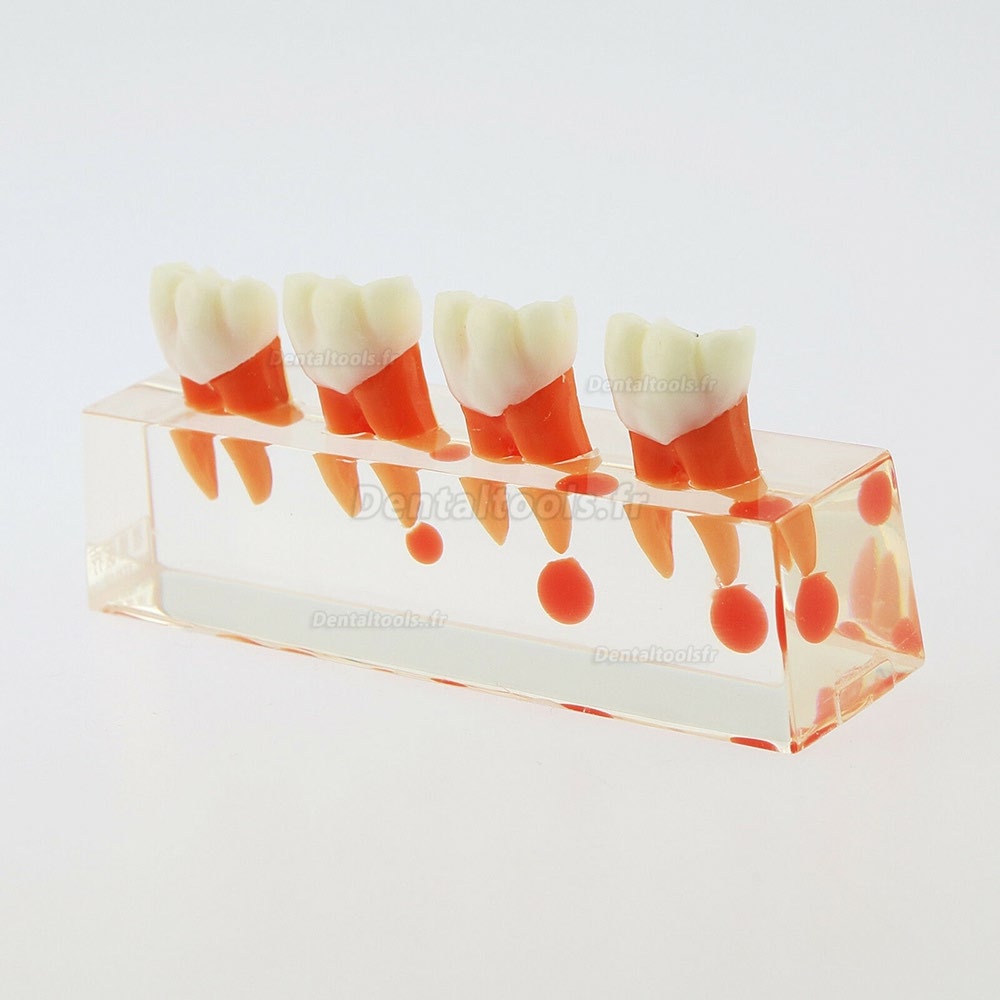 73/5000 Étude de traitement endodontique à 4 étapes de modèle de dents dentaires Teach Model 4018 01