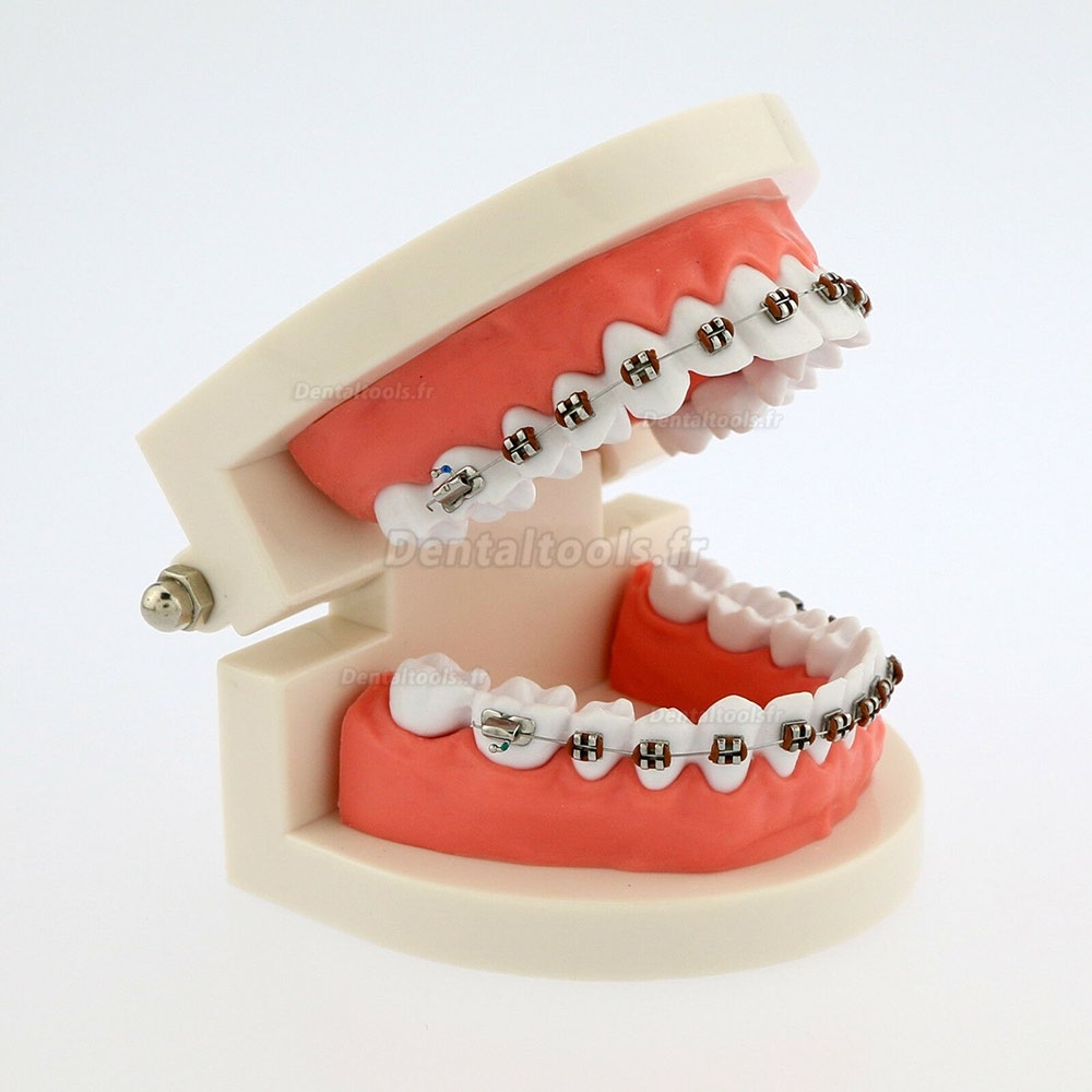 Démonstration Typodont de l'enseignement dentaire Modèle de dents avec attelles pour patient étude 5006