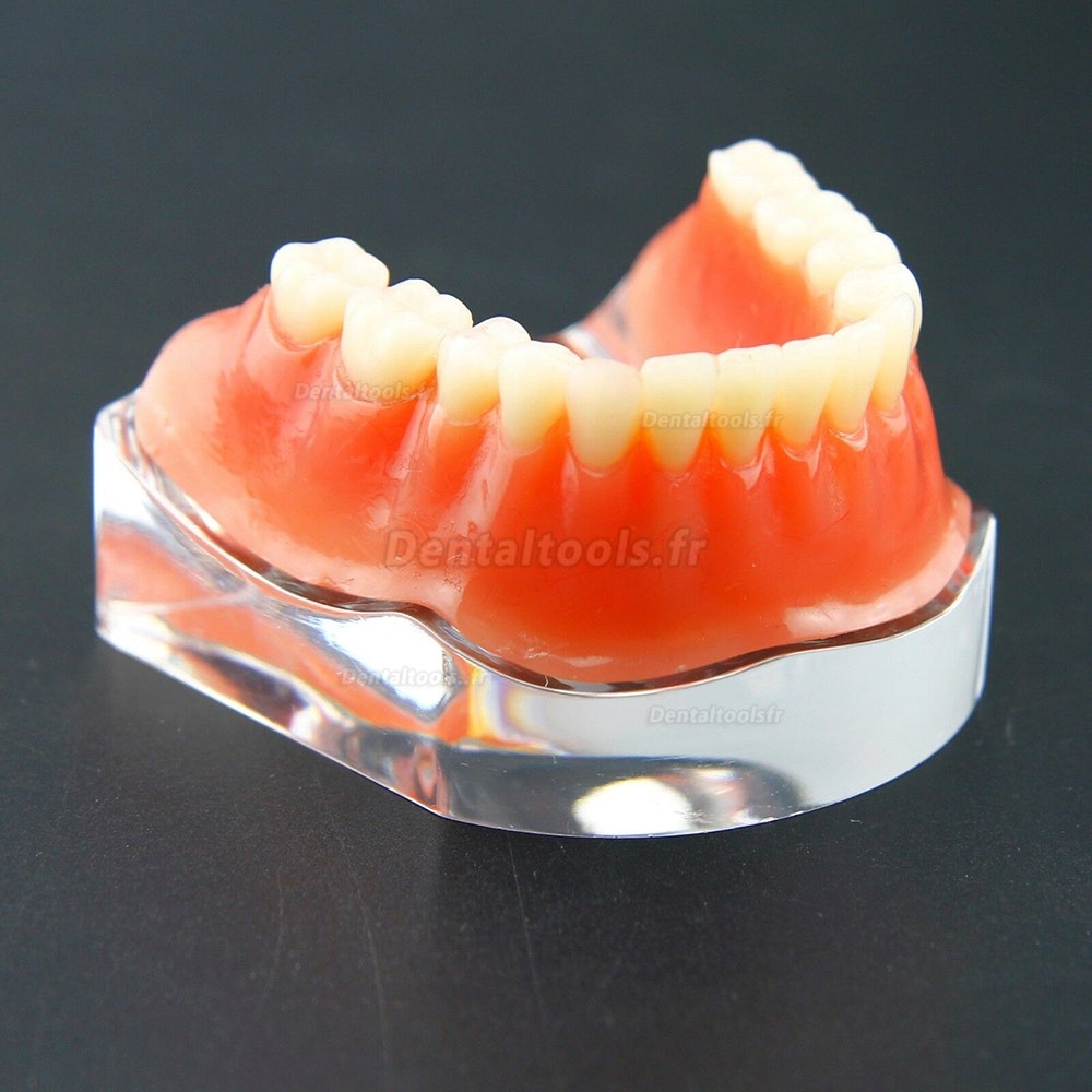 Dentaire modèle Typodont implant de précision inférieure 4 implants 6009 doré