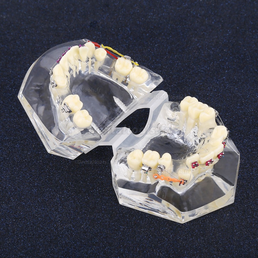 Modèle orthodontique dentaire Traitement de Malocclusion Avec crochets de chaîne SG