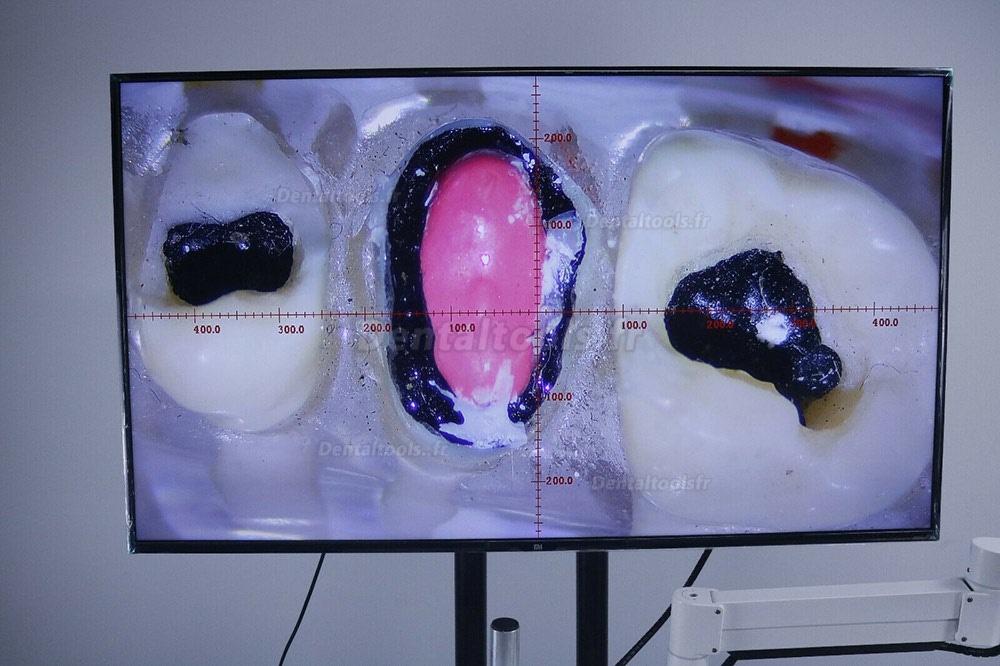 Microscope opératoire dentaire endodontie avec caméra pour fauteuil dentaire