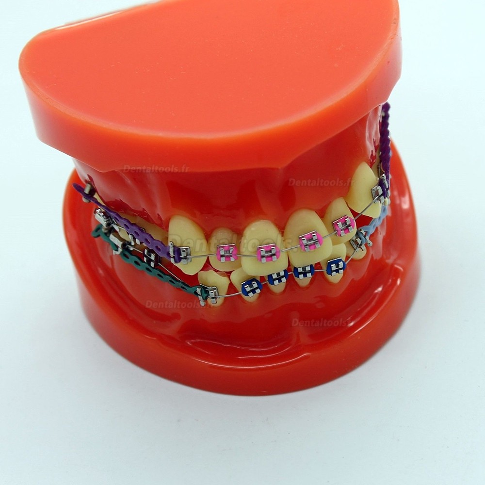 Modèle d'étude de traitement d'orthodontie dentaire avec support d'orthodontie et fil d'arc