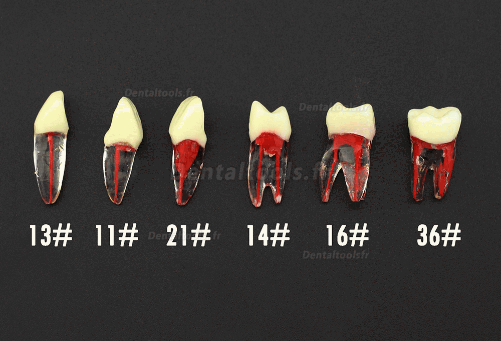 Dents Dentaire RCT Endo Typodont Compatible avec Kilgore Nissin