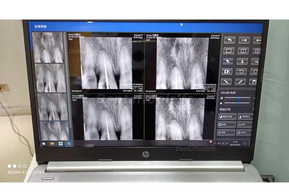 Capteur Radio Dentaire RVG Capteur Intraoral Radiologique Dentaire Numérique